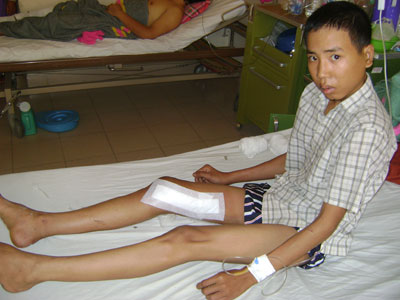 Điều trị thành công 2 ca tổn thương mạch máu phức tạp