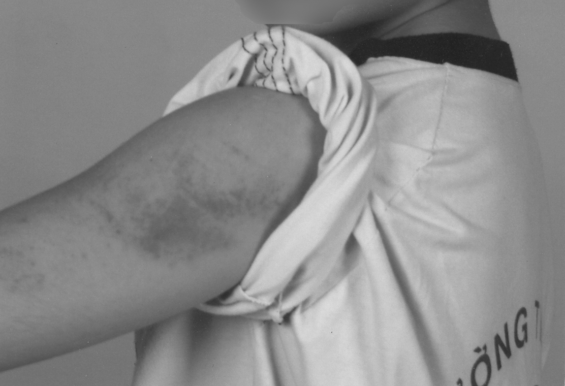 Cần kiên quyết xử lý