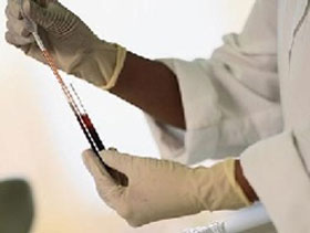 Thử máu có thể dự đoán tuổi thọ