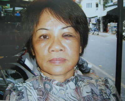 Cơ quan Công an đã làm theo quy định!