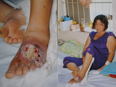 Chị Mai Đặng Thị Hồng cần được giúp đỡ