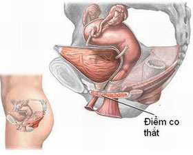 Đi tiểu đúng cách có lợi cho sức khỏe
