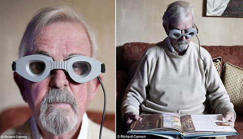 Kính điện điều trị khô mắt