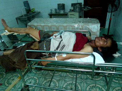 3 công nhân bị thương khi đang sửa chữa tàu biển