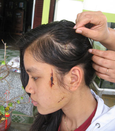 Lại báo động về nạn bạo lực học đường