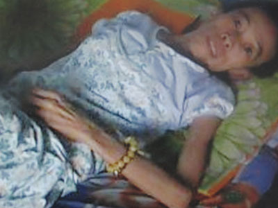 Nỗi khổ của một phụ nữ bị ung thư