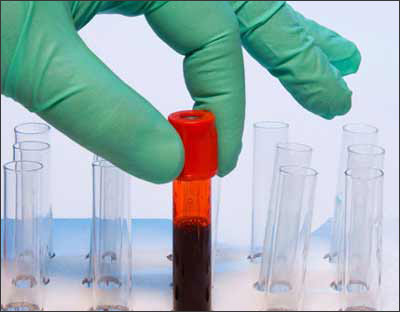 Xét nghiệm máu giúp phát hiện bệnh ung thư