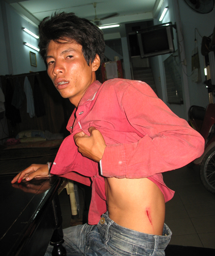 Bài học trong việc xử lý tình huống