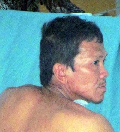 Dùng mã tấu chém Công an