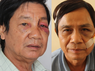 2 bảo vệ chung cư bị người nước ngoài hành hung