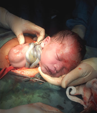 Thai phụ không nên xem thường