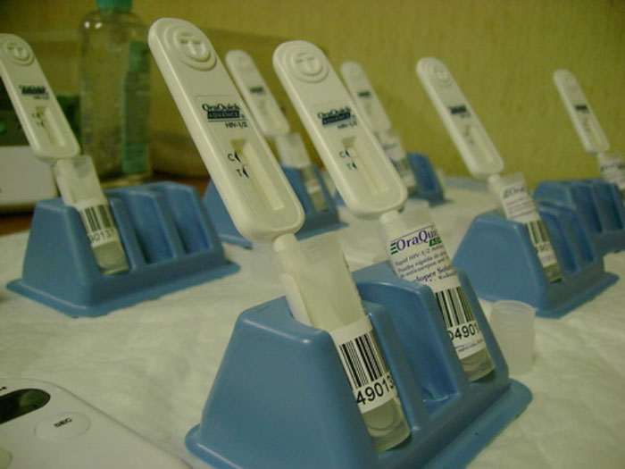 Sắp có dụng cụ xét nghiệm HIV tại gia