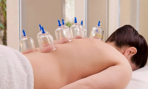 Điều cần biết về giác hơi