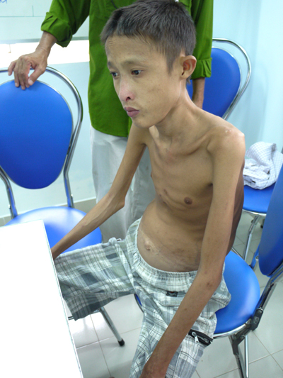 Một gia đình thương binh cần giúp đỡ