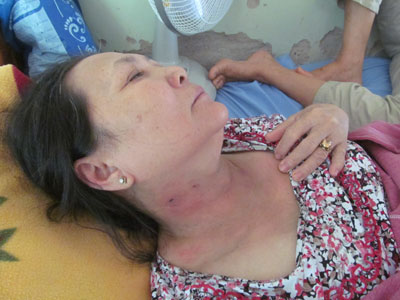 Côn trùng lạ xâm nhập bệnh viện