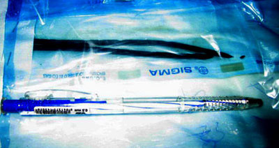 Phẫu thuật lấy 2 que sắt trong bụng bệnh nhân