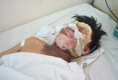 Bỗng dưng… bị chém lúc nửa đêm