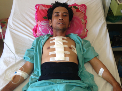 Cứu sống 2 trường hợp chấn thương ngực kín gây vỡ tim