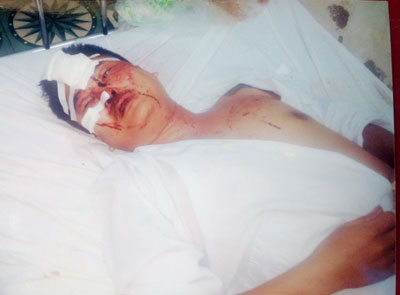 Đánh người kiểu "xã hội đen"