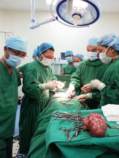 Phẫu thuật lấy khối u nặng 2,3 kg trong bụng bệnh nhân