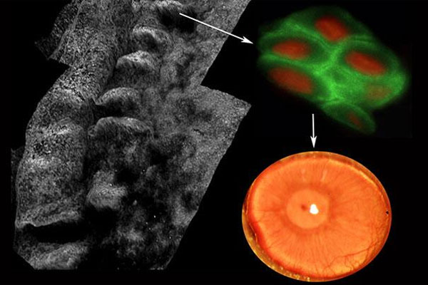 Đột phá mới giúp người mù sáng mắt