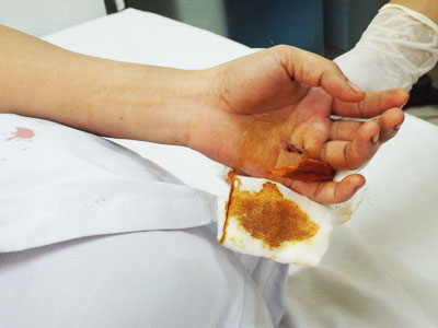 Lại chuyện côn đồ hành hung ở bệnh viện