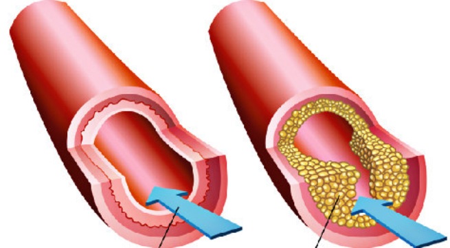 Hy vọng mới cho bệnh nhân mắc chứng rối loạn máu
