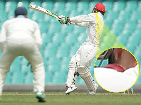 Quả bóng đập trúng gáy của Phillip Hughes.