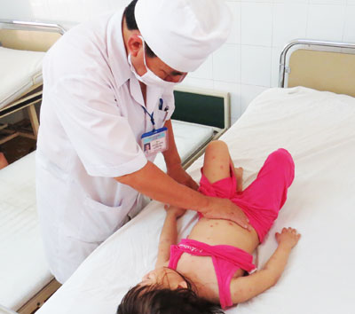 Khi trẻ mắc bệnh tay chân miệng, cần nhanh chóng đưa đến cơ sở y tế.