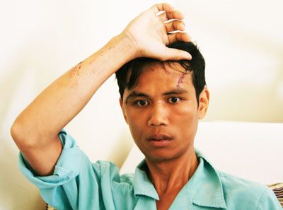 Anh Vương đang được điều trị tại Bệnh viện Đa khoa tỉnh. 