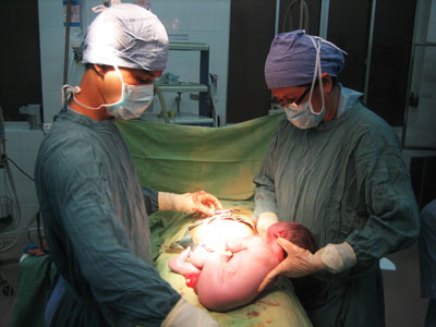 Mổ lấy thai: Vẫn có biến chứng cho mẹ và trẻ