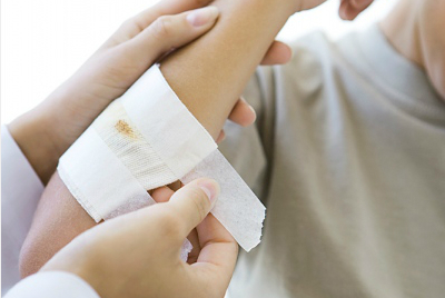 Vết thương trầy xước nếu không xử trí đúng cách có thể gây sưng nề, sẹo xấu... Ảnh minh họa.