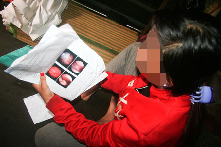 Chị Tuyền trình bày việc nhiều lần bị cha dượng bạo hành