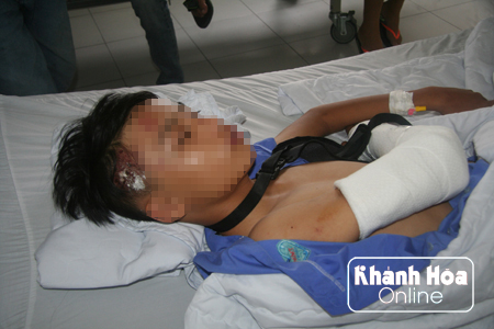 Những vết thương khắp vùng đầu, tay em H