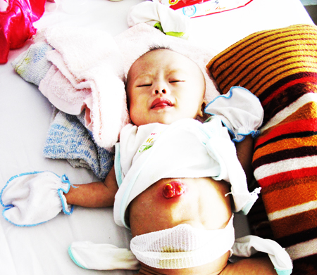 Mới hơn 2 tháng tuổi đã mắc nhiều bệnh hiểm nghèo