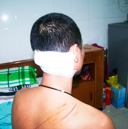 Đang ngồi nhậu, 2 thực khách bị chém gục