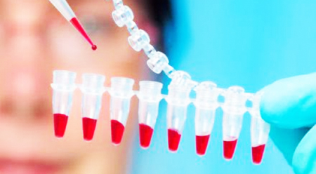 Bộ cảm biến xét nghiệm nhanh protein và men trong máu