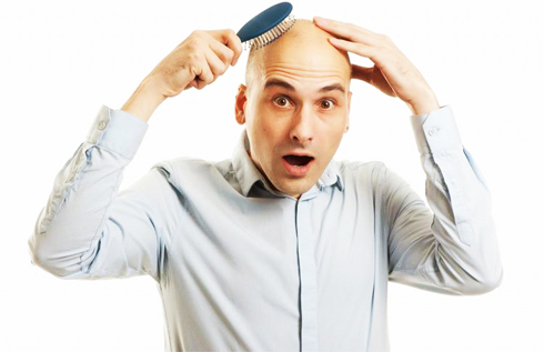 Hói đầu,bạc tóc, nỗi khổ tâm không của riêng ai