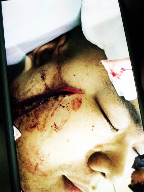 Đi đòi nợ bị truy sát