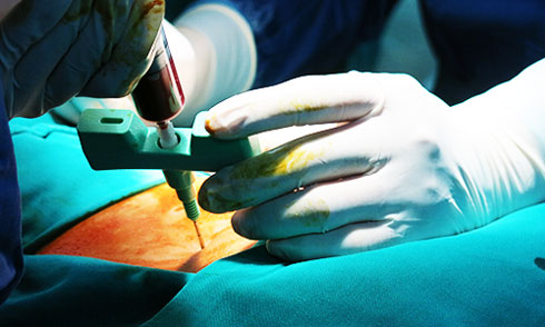 Việt Nam ứng dụng thành công kỹ thuật ghép tế bào gốc giá rẻ