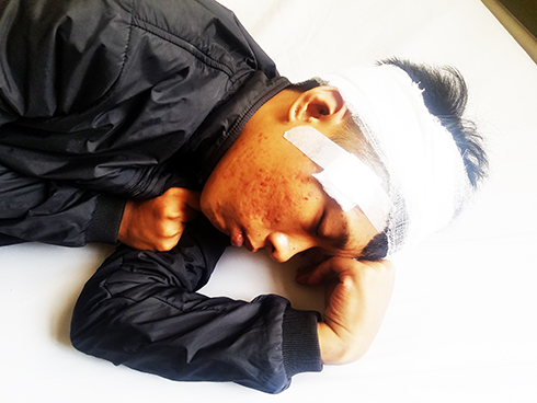 Bị đánh, chém vô cớ lúc nửa đêm