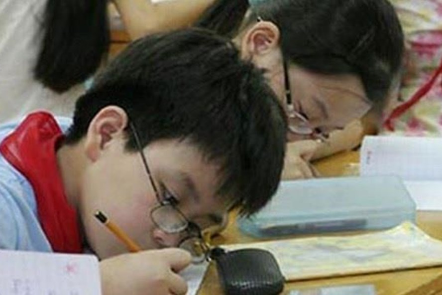 Cận thị - Phát hiện sớm, trẻ đỡ khổ