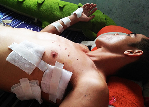 Bỗng dưng bị bắn