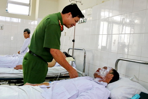 Hai chiến sĩ chữa cháy bị bỏng độ 2, độ 3