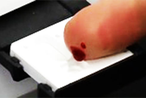 Thiết bị cầm tay có khả năng phát hiện ung thư