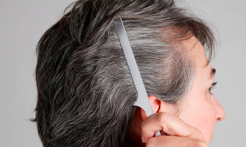 Mái tóc tiết lộ tình trạng sức khỏe của bạn