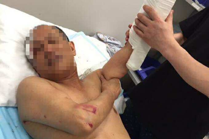 Làm rõ vụ nhân viên nhà hàng và khách du lịch ẩu đả trước ngày 20-5