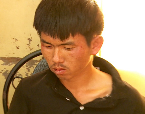 Bắt nghi can chém người, cướp tài sản trong đêm