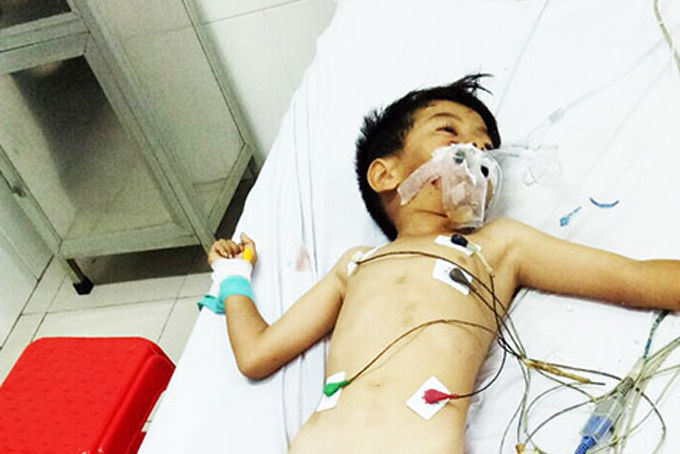 Hoàn cảnh thương tâm của bé 6 tuổi bị tai nạn giao thông