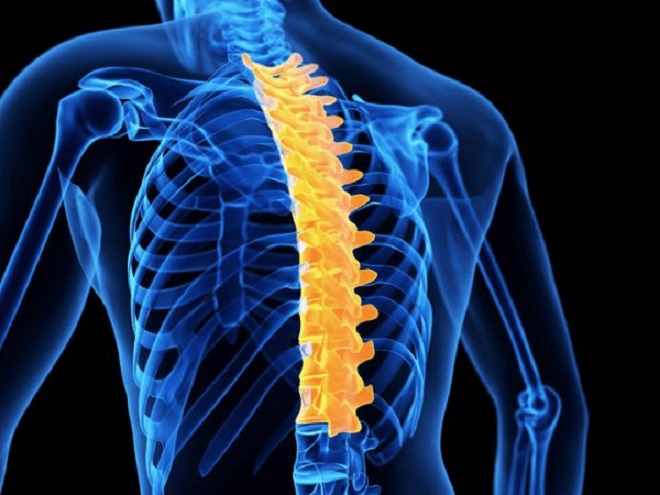 Nhận biết 4 dạng vẹo cột sống